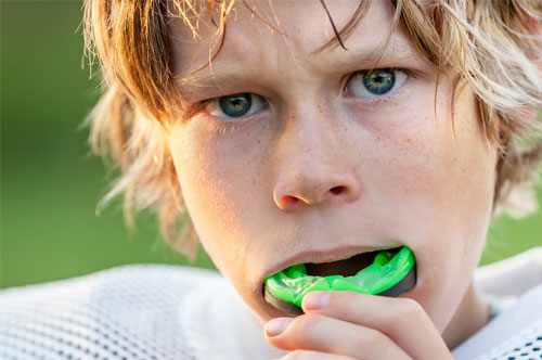 Protect Winning Smiles With Custom Mouthguards