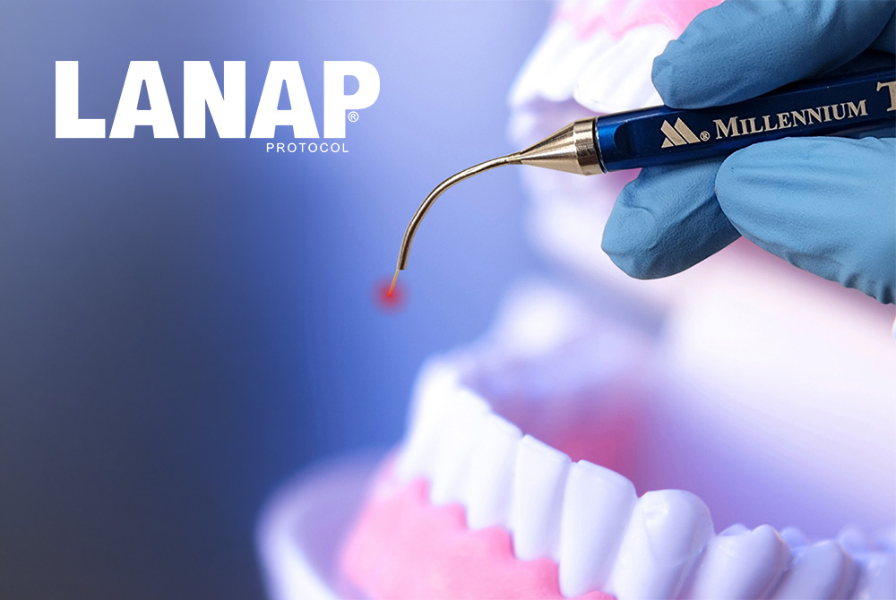1000x670-LANAP-Procedure-W:Logo-08-White